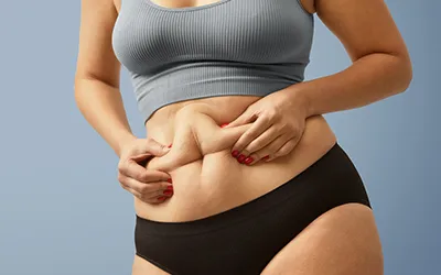 Post Bariatric Surgery