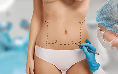 Tummy Tuck